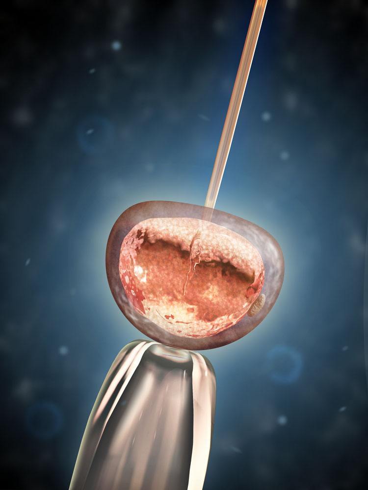 潮红与皮肤血管舒张反应