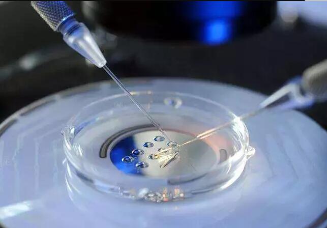 温州辅助生殖技术准备工作