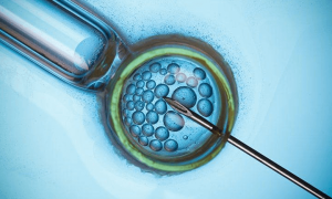 温州不孕不育人群辅助生殖技术现状分析