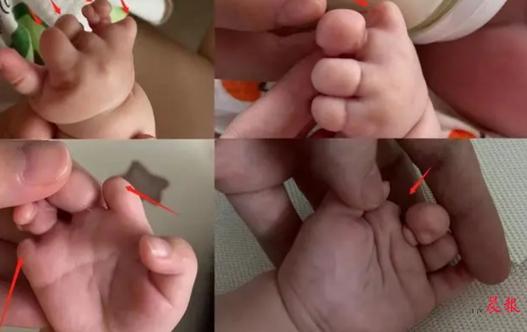 湖北省试管婴儿医院选择策略分析